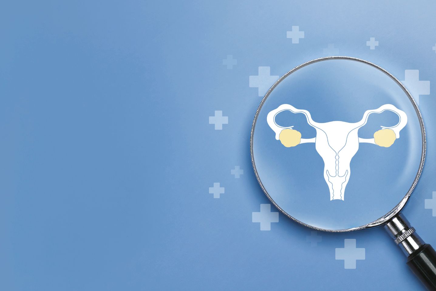 Blog about Malignant ascites as a source of patient-derived ovarian cancer models