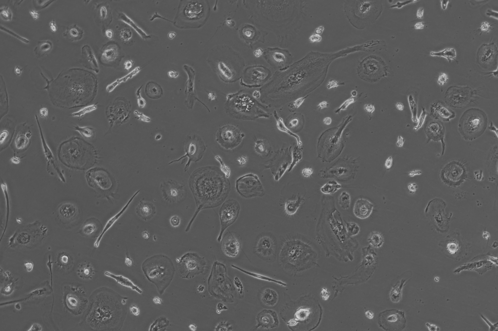 Mesothelial cell enriched population 10x