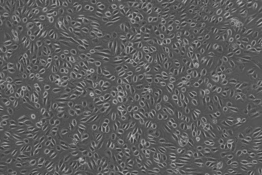 Epithelial/cancer enriched population 10x