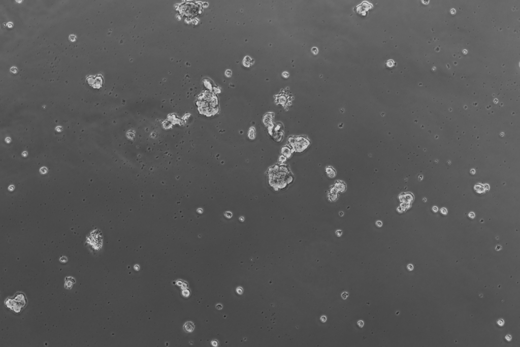 Epithelial/cancer enriched spheroids 10x
